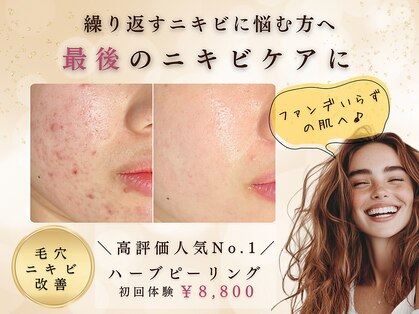 オーキッド(ORCHID)の写真