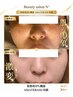【結果重視★シミ・くすみ徹底ケア】フェイシャル×美容液導入 ￥19,800