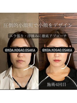 コア 心斎橋 堀江店(koa)/お客様ビフォーアフター