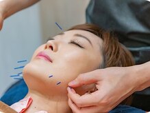 アライブ鍼灸マッサージ院