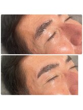 ダリア(Dahlia)/眉毛のワックス脱毛