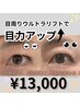 【二重形成超音波】瞼が分厚く腫れぼったい方のお悩み解消◎　13,000円