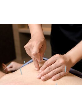 鍼灸施術を受けたい