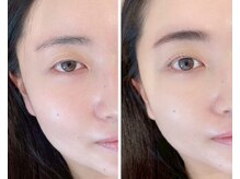 アイル バイ エドゥース(I'LL by et Douce)/まつげパーマ×眉毛WAX