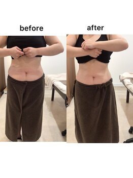 ジョワイユ(Joyeux)/腸の位置でお腹は変わる