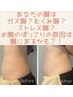 外側から腸を刺激で腸美人!整腸セラピー!腸もみケア