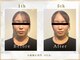 シルク(SILK)の写真/【小顔矯正専門店だからこそできる】女性特有の顔のお悩み・ほうれい線、たるみを徹底的に根本改善します◎