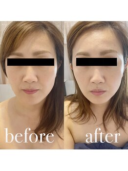 ルルアス(LUluas)/