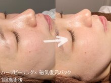 ルーナジェーナ(Luna llena)/池袋　エステ　ルーナジェーナ