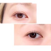 ピュアリー(purely)