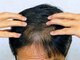 サロンマナ(Salon MANA)の写真/《育毛促進！》最新の頭皮環境改善で速攻性◎頭皮・毛髪のお悩み改善を促します！
