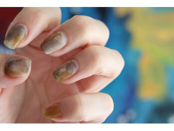 クロ(KURO)/もやもやアート