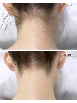 サロン エデンプラス(salon eden PLUS)/うなじワックス