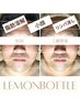 【メンズ限定】レモンボトル／爽やかフェイシャルコース¥15000→10000