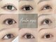 アネラ アイズ(Anela eyes)の写真