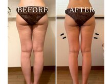 ヨサパーク フェリシア 西荻窪(YOSA PARK Felicia)の雰囲気（モニター募集中♪（顔出しなし可））