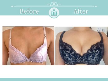 美人バスト 渋谷店/【バストアップ・育乳】症例☆