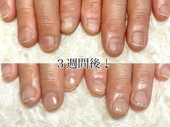 ココモ(cocomo)/(深爪/長さだし/フィルイン/)