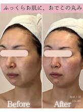 ココロ(COCORO)/ふっくら上向きお肌に♪