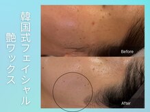 マインエム(mine.m)の雰囲気（毛細血管レベルの鎮静で赤みや乾燥をしっとりつるん肌に）