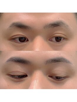 ハク 谷町(HAK.)/メンズ眉毛ワックスBefore/After