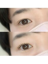 バトン(BATON.)/before/after