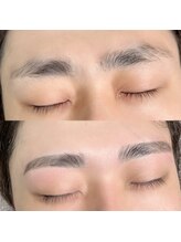 フラックスアンドビューティー(flax&BEAUTY)/Before After