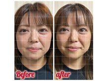 ビューティスパ アイラブミー(BeautySpaILoveMe)の雰囲気（FURERUリフトアップフェイシャル）