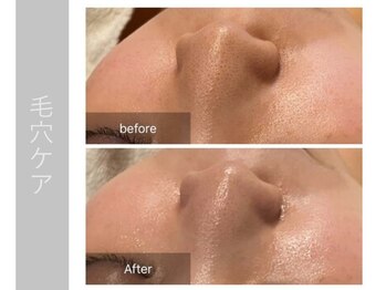 ジョルネ 中目黒(jornee.)/before/after