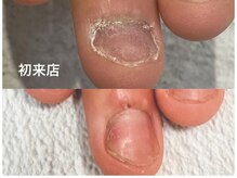 グレースレディ/爪周りまで綺麗に