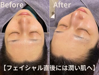 グレース 吉祥寺(grace)/乾燥肌から【潤い肌】に