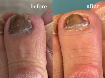 爪のいろは/根本から綺麗な色の爪が…♪