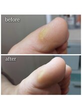 爪切り屋 足楽/