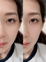 リリラース(Lililas)/