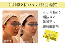 クリニカルエステ/イーズ パークプレイス大分店の雰囲気（【レモンボトル3cc】お顔の脂肪に合わせて打ち放題！¥8800体験）