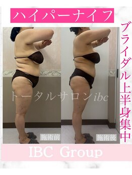 トータルサロンアイビーシー(トータルサロンIBC)/ハイパーナイフ☆ブライダル