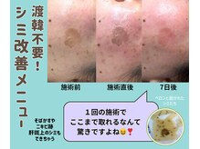 ザ ベッピン(the 別嬪)の雰囲気（2月モニター埋まりました！3月モニター→【@beppin_facecare】）