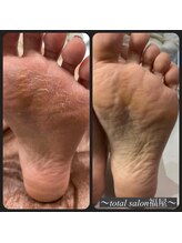 福屋/本格フットケア