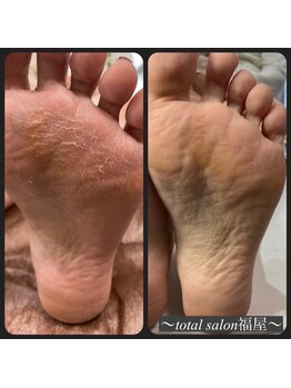 福屋/本格フットケア