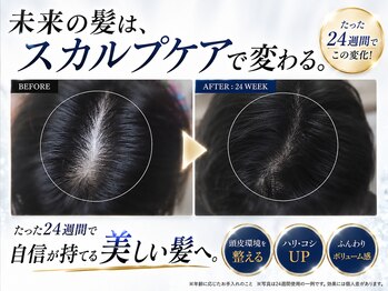 BLD/クリニカルスカルプケアB&A