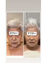 クレビア(CREVIA)/リアボーテタラソトリートメント