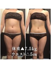カンフリエ 吉野ヶ里店(Camphrier) 痩せるなら カンフリエ