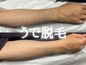 【好印象間違いなし!】うで全体脱毛　16,500円→8,800円