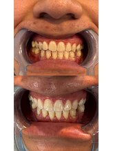 アレッド 大阪店(ared.)/お得にホワイトニング