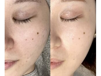 スリリアン 銀座/★お客さまビフォーアフター