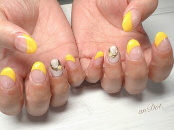 イエローフレンチ