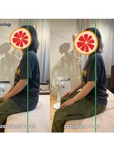 グレフル鍼灸接骨院 整体院 心斎橋/整体/肩こり/マッサージ/腰痛