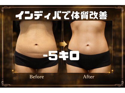 ヴィアス(VIAS)の写真