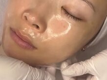 irisの雰囲気(内側から弾むような、理想のうるつやハリ美肌へ導きます◎)