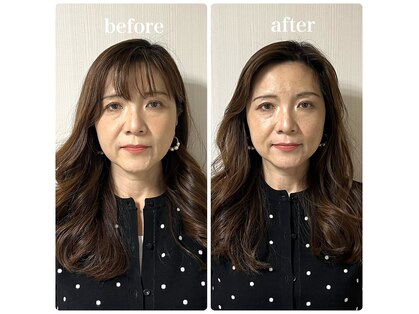 ラリマールの写真